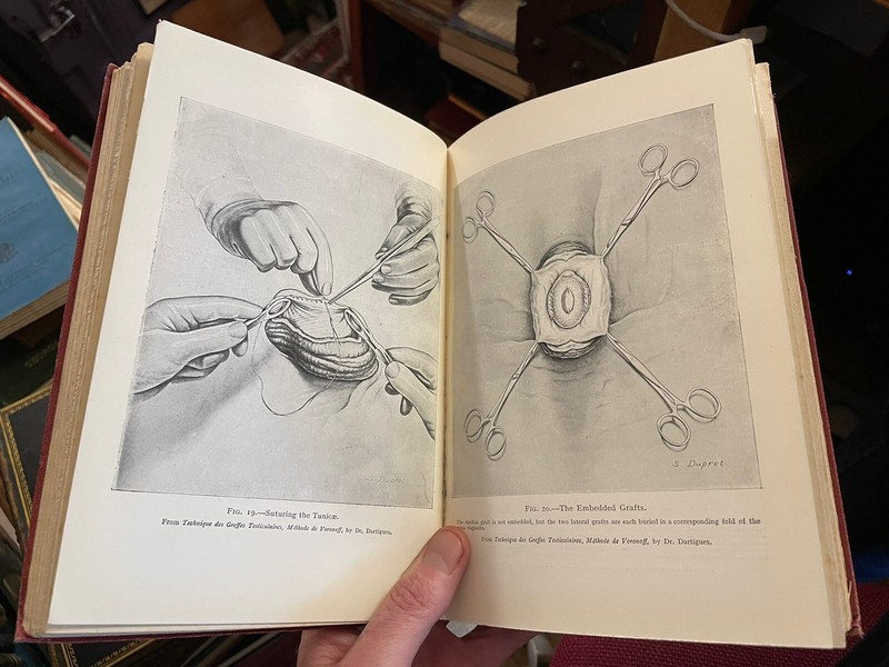 Rejuvenation By Grafting : Testicular Grafting from Monkey to Man : Medical 1925 gallery