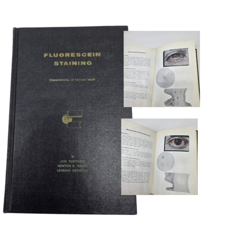 1959 Fluorescein Staining Corneal Insult Contact Lens Ophthalmology HC Scarce