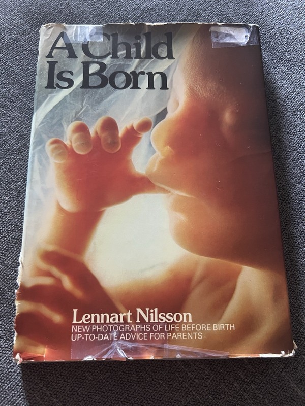 A Child Is Born by Lennart Nilsson (hard cover) 159 pages