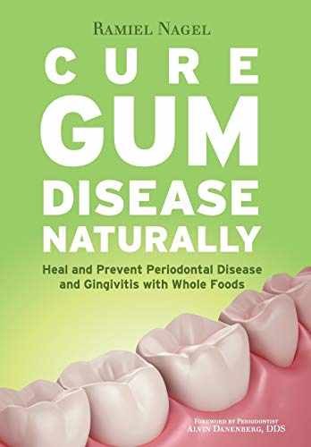 Cure Gum Disease Naturally: Heal and – Paperback, by Nagel Ramiel – Acceptable