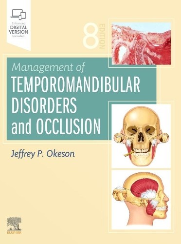 Jeffrey P. Okes Management of Temporomandibular Disorders (Hardback) (UK IMPORT)